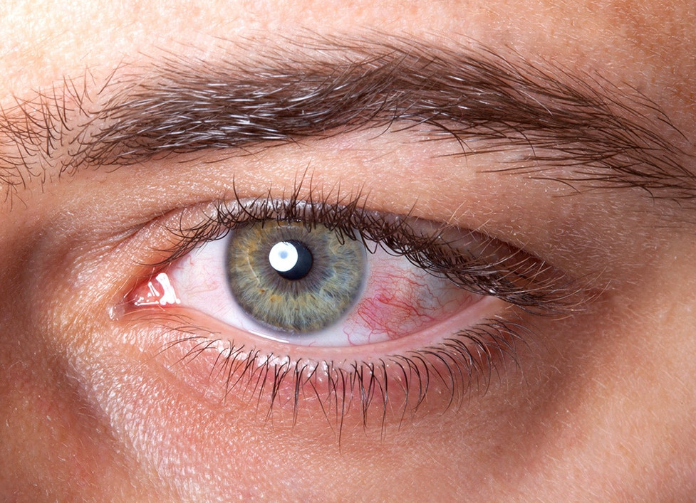 Tips to reduce eye strain
